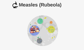 Measles (Rubeola) 