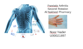 Copy of Psoriatic Arthritis by Ahmad Saad on Prezi Copy of Psoriatic Arthritis by Ahmad Saad on Prezi