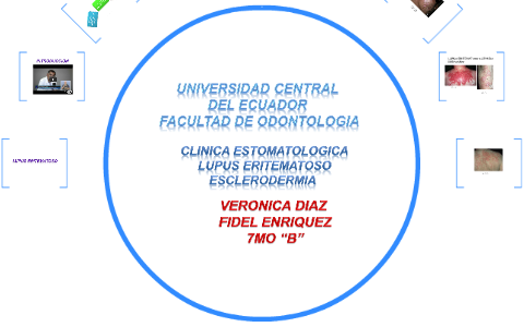 ESPALDA by VERONICA DIAZ LOPEZ on Prezi