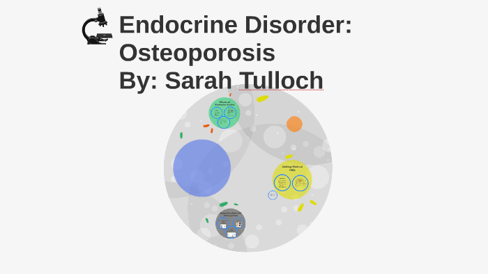 Endocrine Disorder: Osteoporosis By Sarah Tulloch