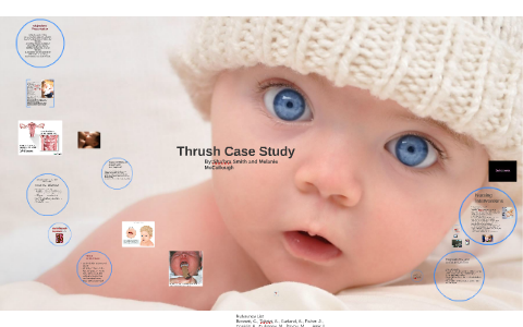 Chronic mucocutaneous candidiasis stat1 image