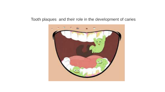 Tooth plaques and and their role in the development of carie by Nana ...