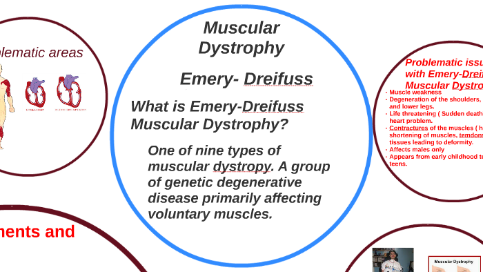 Muscular Dystrophy ( Emery- Dreifuss) by chantel webb on Prezi