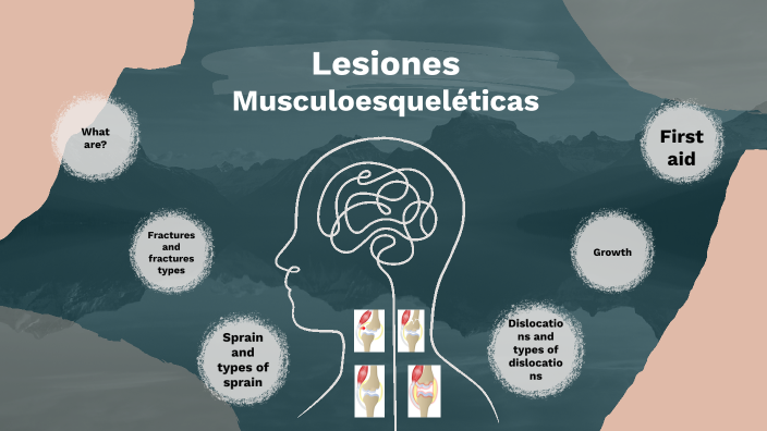 Lesiones Musculoesqueleticas by Alexandra Zambrano on Prezi