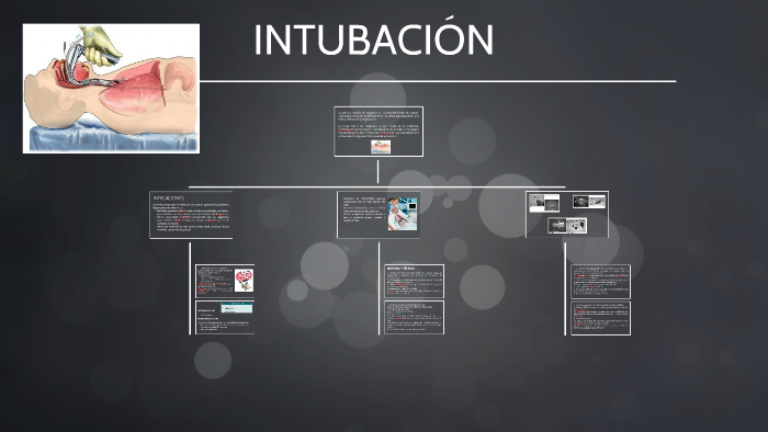 CRITERIOS DE INTUBACION by Blanca García on Prezi