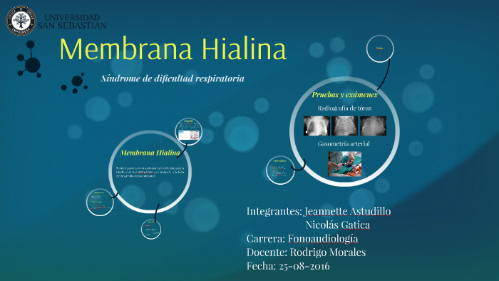 Membrana Hialina by Nicolás Bravo on Prezi