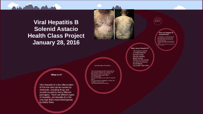 Viral Hepatitis B Project by Solenid Astacio on Prezi