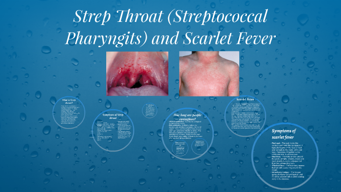 Scarlet Fever and Streptococcal Infections - What Are They?