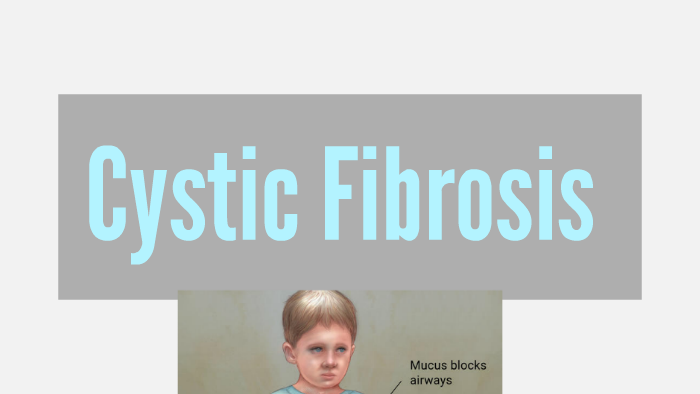 Cystic Fibrosis by lauren inman on Prezi