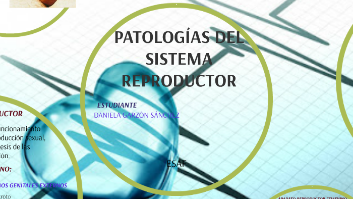 PATOLOGÍAS DEL SISTEMA REPRODUCTOR By Laura Daniela Garzón Sánchez On Prezi