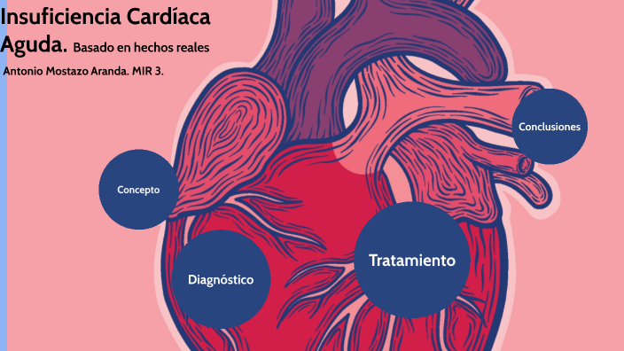 Insuficiencia Cardíaca Aguda By Antonio MA On Prezi