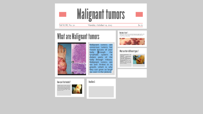 Malignant tumors by jasmine elizondo on Prezi