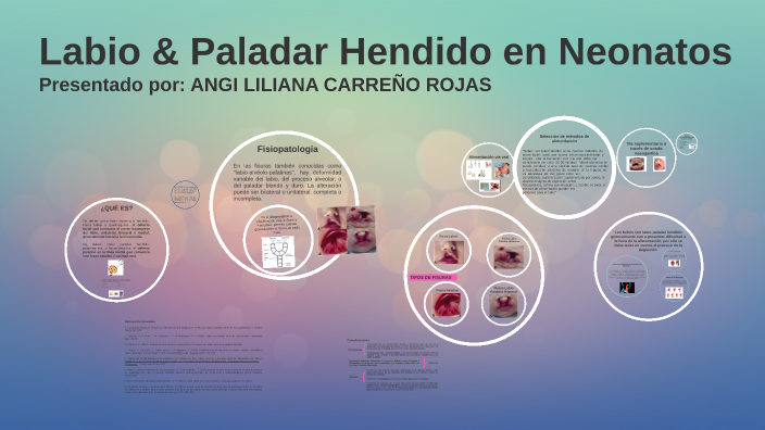 Labio Y Paladar Hendido En Neonatos By Liliana Carreño Rojas On Prezi 1598