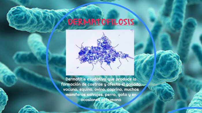 DERMATOFILOSIS by xiomara avila on Prezi