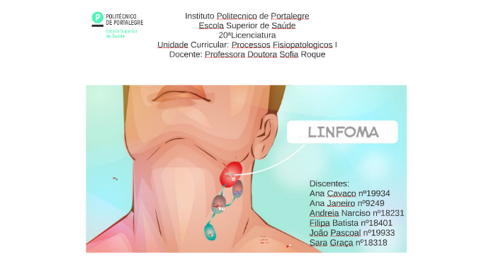 Linfoma De Hodgkins By Sara Graça 3488