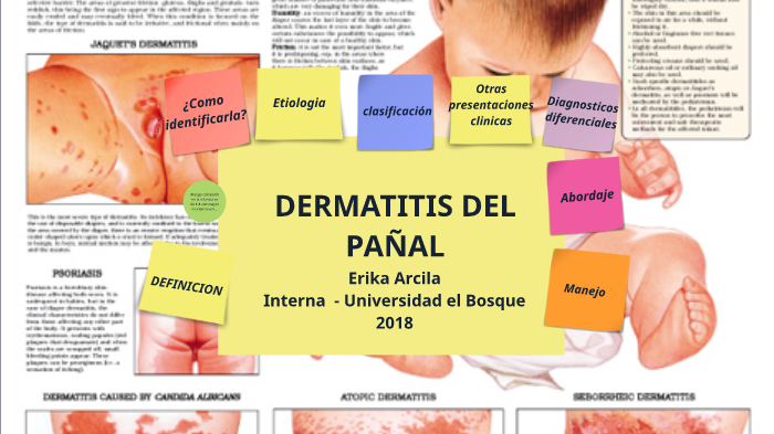 DERMATITIS DEL PAÑAL by ERIKA ARCILA on Prezi