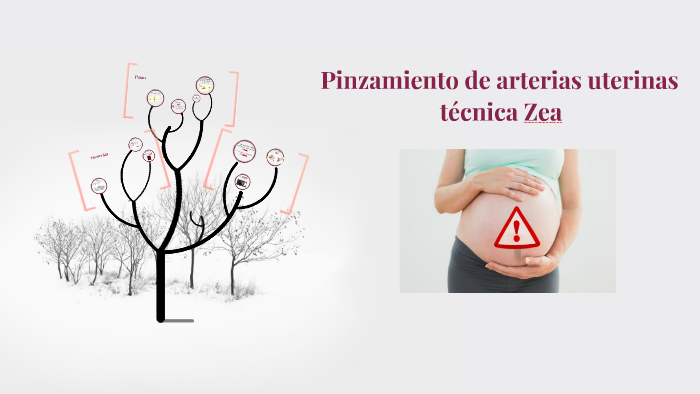 Pinzamiento de arterias uterinas by pao macias on Prezi