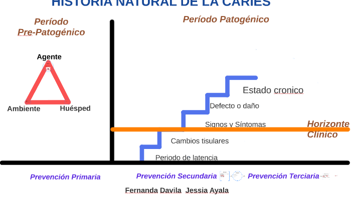 HISTORIA NATURAL CARIES by Fernanda Davila on Prezi