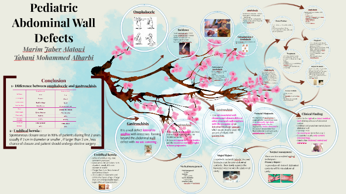 Pediatric Abdominal Wall Defects by Tahani Moh on Prezi