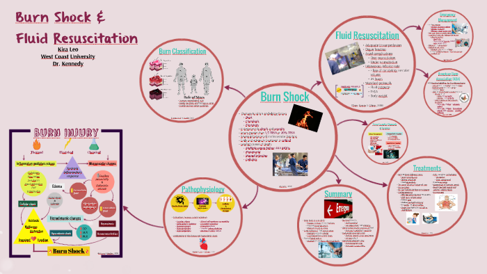 Burn Shock and Fluid Resuscitation by on Prezi