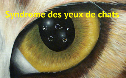 Syndrome Des Yeux De Chats By Sara Matthews