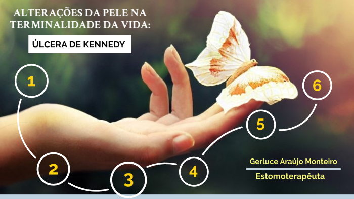 úlcera de kennedy by Mari Araújo on Prezi