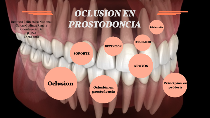Teorías de la oclusión by Renata Garcia on Prezi