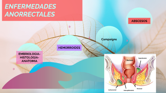 ENFERMEDADES ANORRECTALES by Deysi Callisaya on Prezi