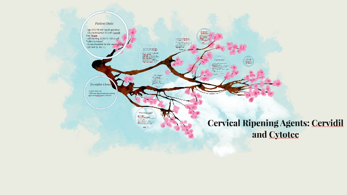 Cervical Ripening Agents Cervidil And Cytotec By Sami Bissonnet