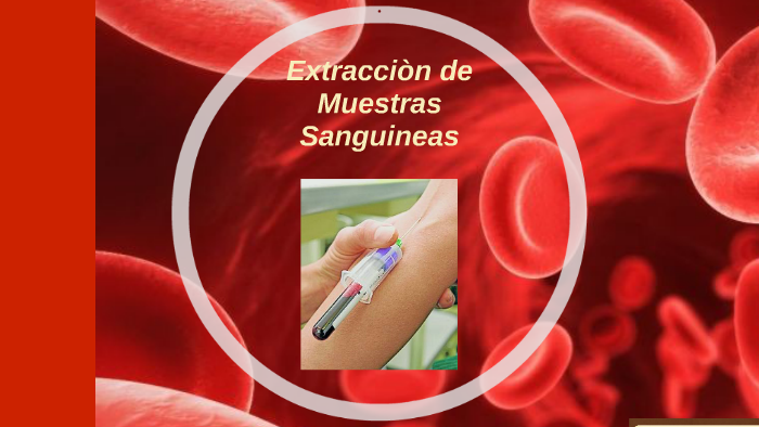 Extracciòn de Muestras Sanguineas by katherine rojas