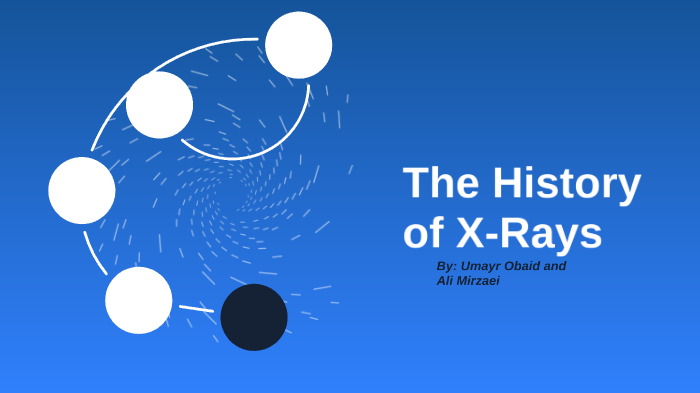 history of x rays essay