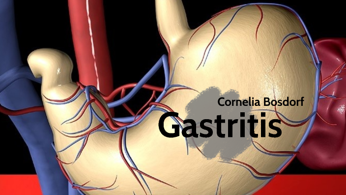 akute chronische Gastritis by cornelia Bosdorf