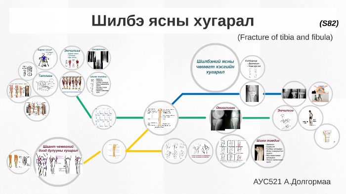 Шилбэ ясны хугарал by Altaa Dolgormaa on Prezi