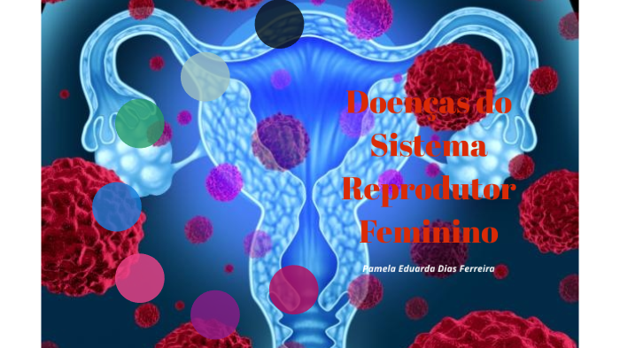 Doenças do Sistema Reprodutor Feminino by Mari Dias on Prezi