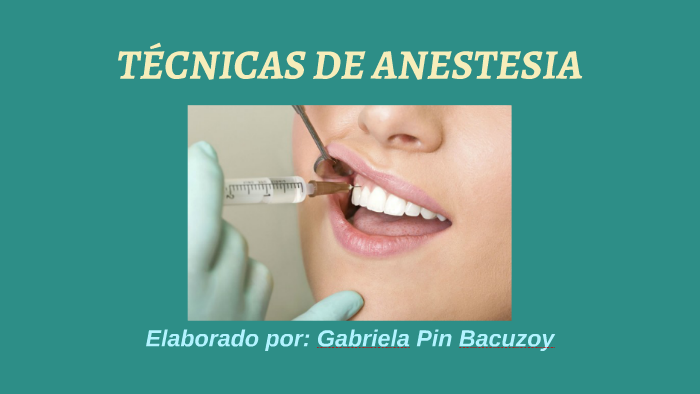 TÉcnicas De Anestesia By Gabriela Pin Bacuzoy On Prezi