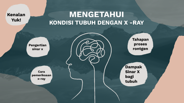 Mengetahui Kondisi Tubuh dengan Pemeriksaan X-Ray by ragil kurniawan