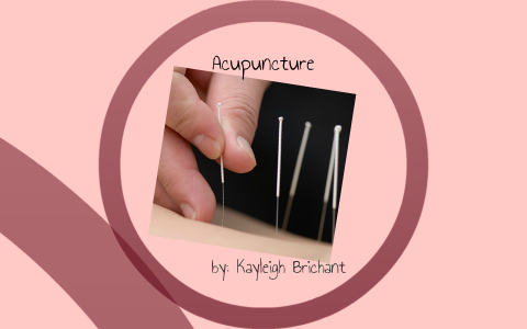 Senior Exit Acupuncture By Kayleigh Brichant On Prezi   4z6f3ayr3efj6ezsoidvbs6dyp6jc3sachvcdoaizecfr3dnitcq 3 0 