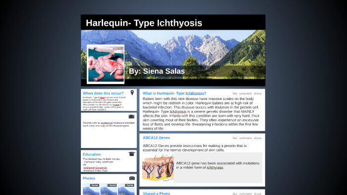 Harlequin- Type Ichthyosis by Siena Salas on Prezi