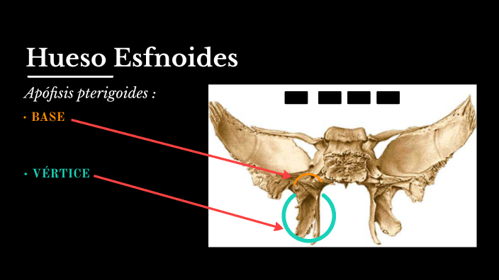 pofisis Pterigoides By Xeveco Vela On Prezi pofisis Pterigoides By Xeveco Vela On Prezi