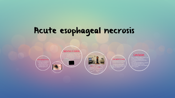 Acute esophageal necrosis by Korey Burgos on Prezi