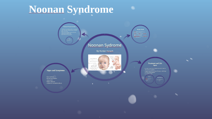 Noonan Syndrome by Hunter Harach on Prezi