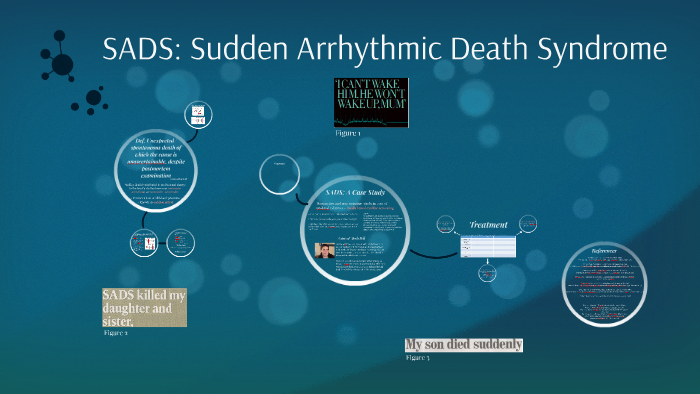 SADS: Sudden Arrhythmic Death Syndrome by Hodan TheFudge on Prezi