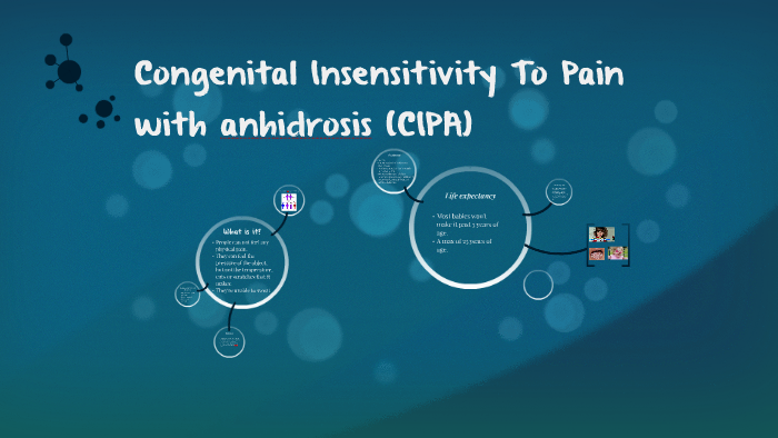 Congenital Insensitivity To Pain by Marco Castro on Prezi