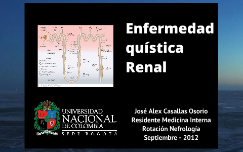 Enfermedad Poliquística Renal by Alex Casallas