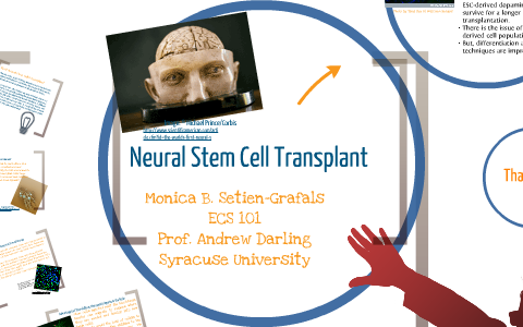 Neural Stem Cell Transplant By Monica Setien-Grafals