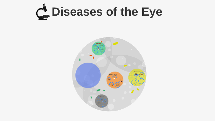 Dieases of the Eye by Stephanie Lankford on Prezi