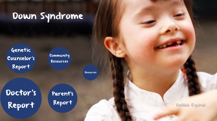 Down syndrome (Genetics Disorder) by Dalilah Espinal