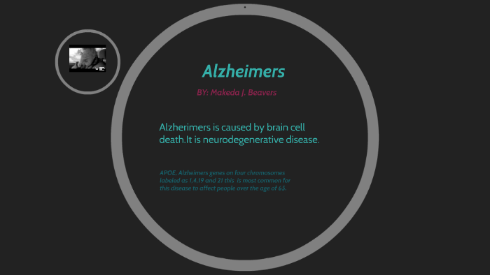 Alzheimers by Makeda Beavers on Prezi