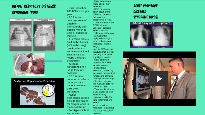 Infant RDS by Jameson Petty on Prezi