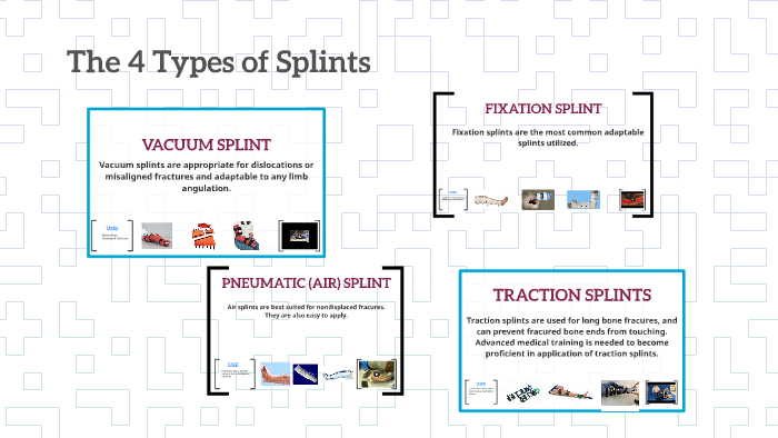 The 4 Types of Splints by Katie Threet